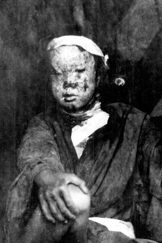 hiroshima child